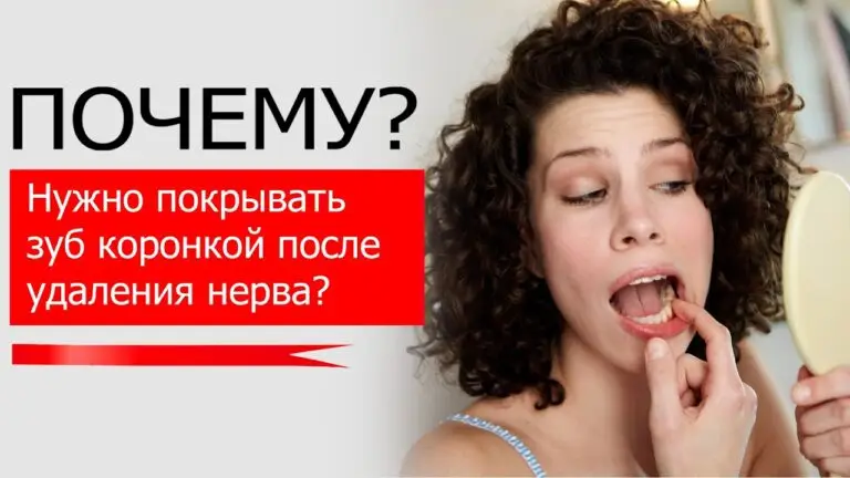 Почему нужно покрывать зуб коронкой после удаления нерва