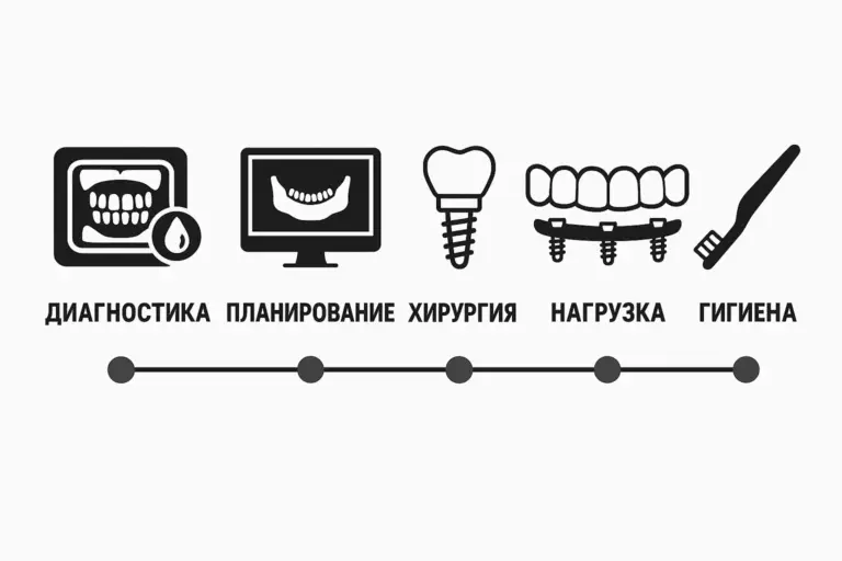 Стратегия победы: 5 этапов надежной имплантации