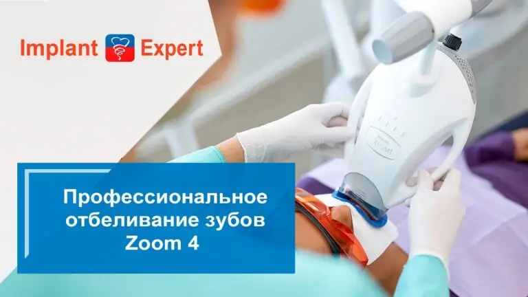 Профессиональное отбеливание зубов Zoom 4 в клинике Implant Expert