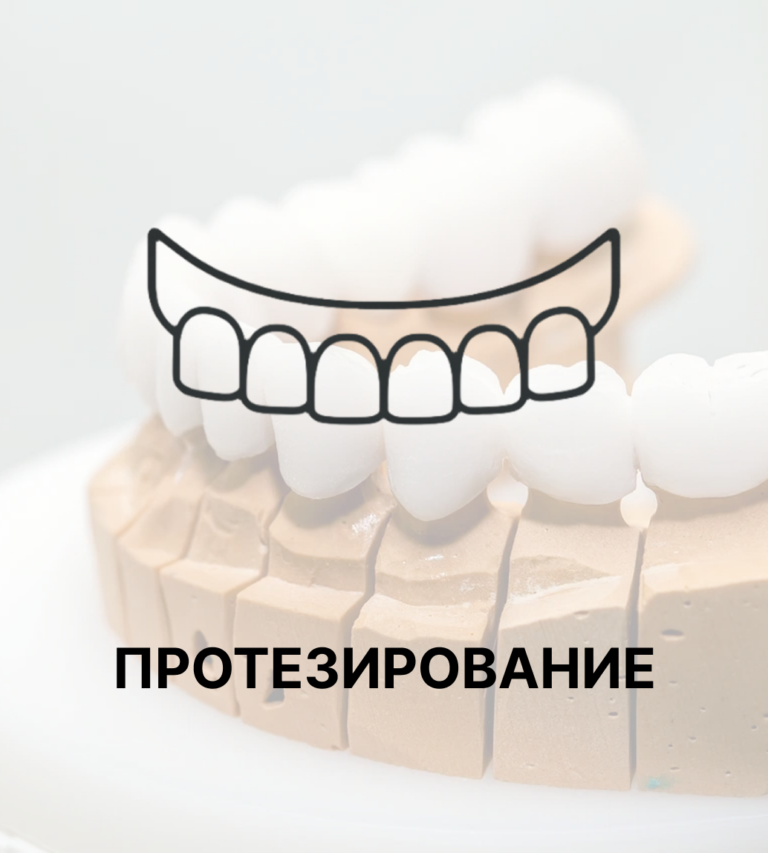 Протезирование