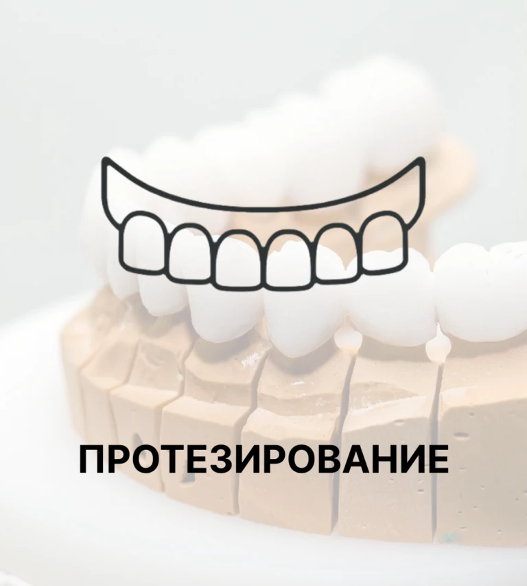 Протезирование