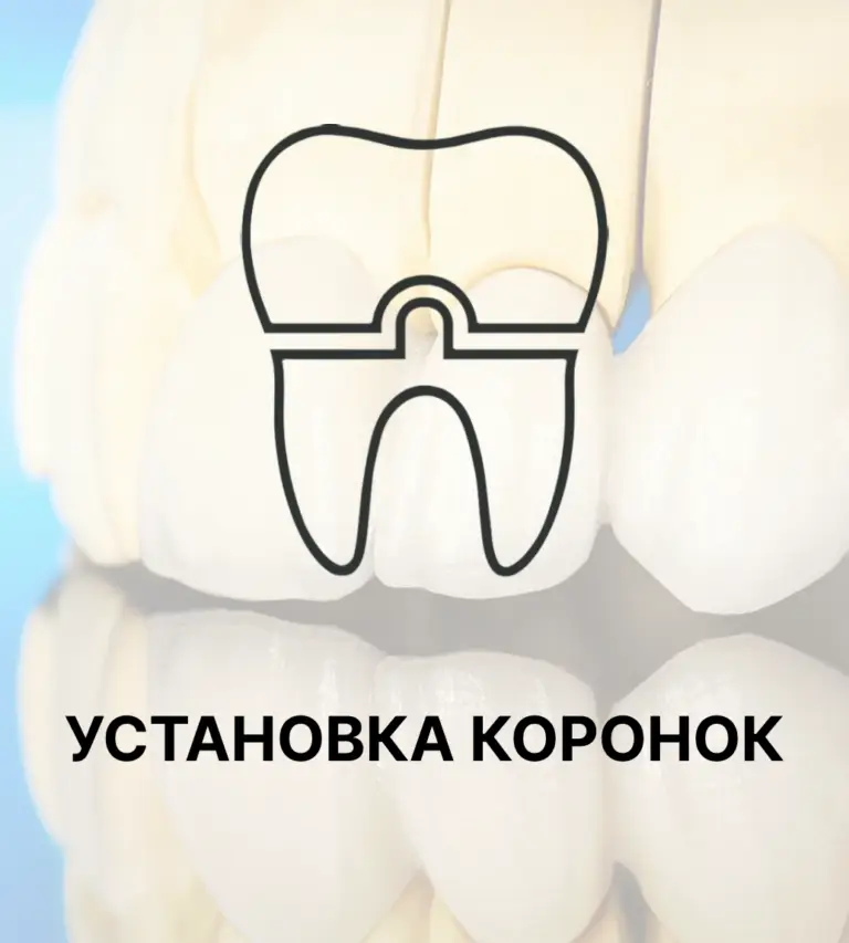 Установка коронок