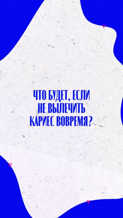 Что будет, если не лечить кариес вовремя — видео