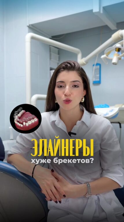 Элайнеры хуже брекетов: правда или миф — видео