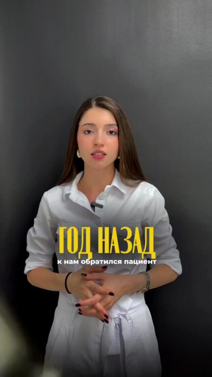 Этапы исправления прикуса капами — видео