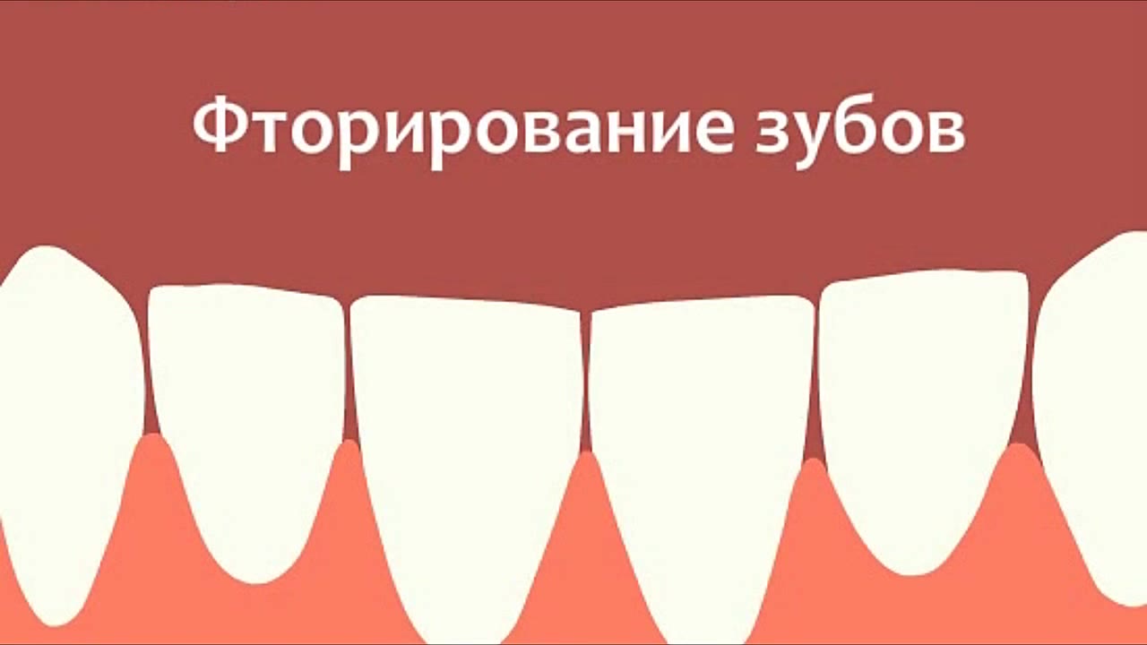 Фторирование зубов: зачем его проводят — видео