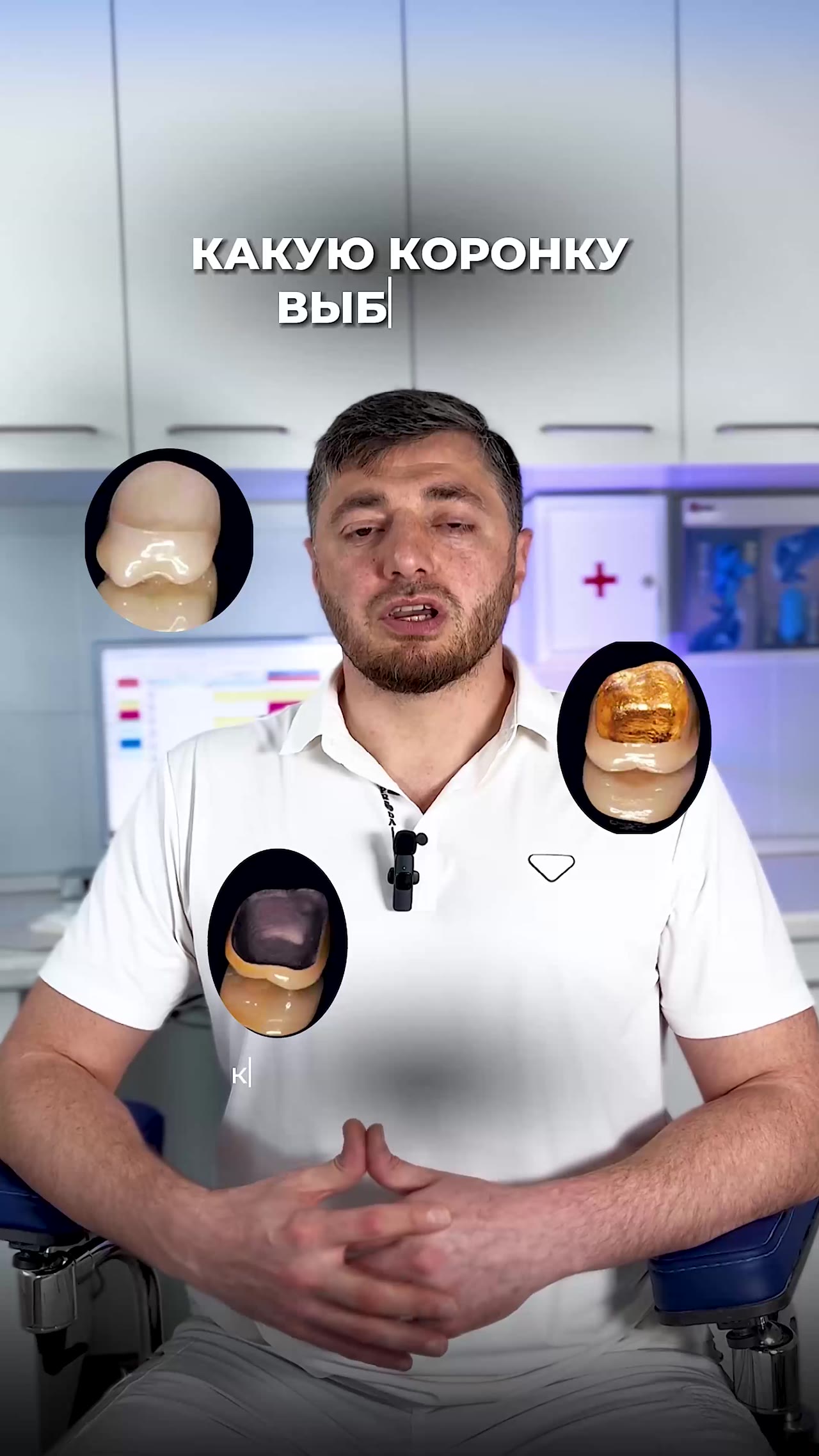 Какую зубную коронку выбрать — видео