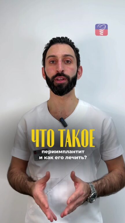 Периимплантит: причины и лечение — видео