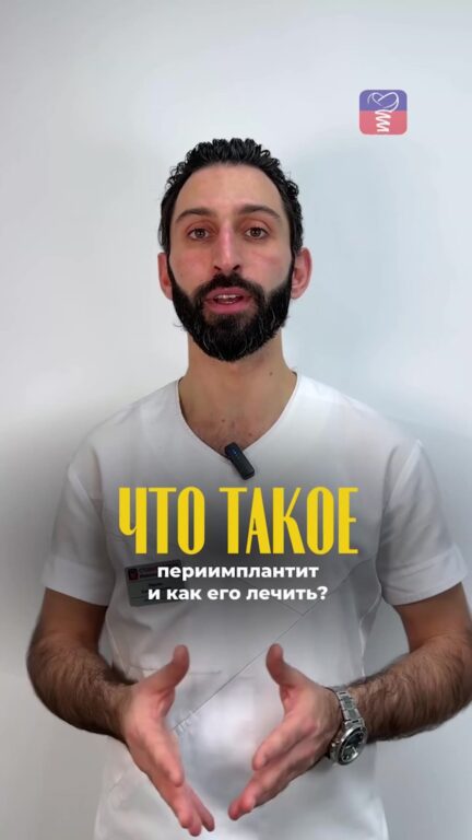 Периимплантит: что это и как его лечат — видео