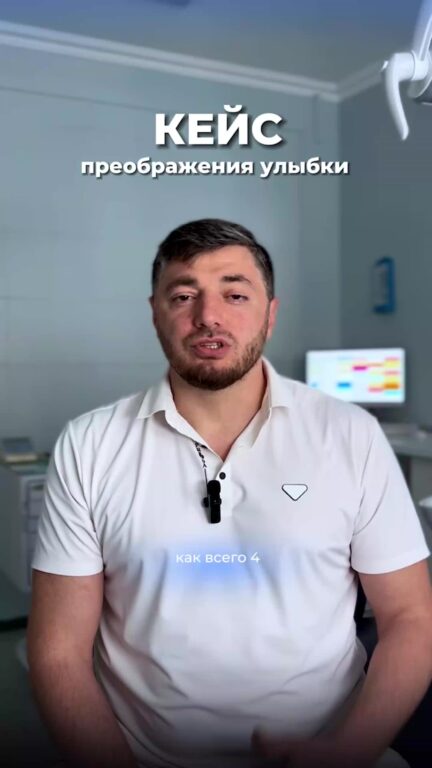 Реставрация зубов: клинический случай — видео