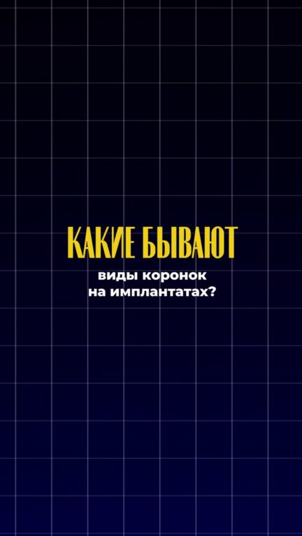 Виды коронок на имплантах — видео